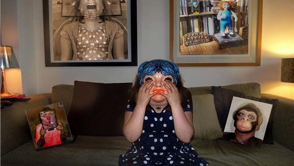 متلازمة تود 