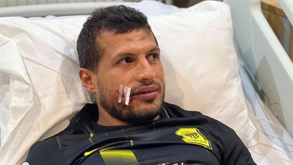 طارق حامد بعد خضوعه