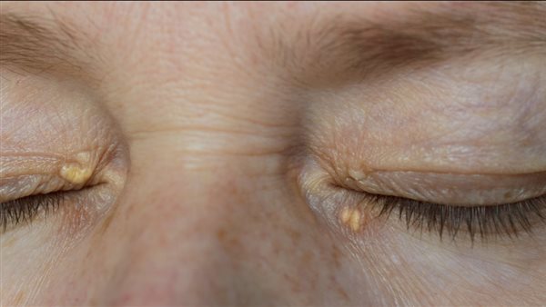 العين - أرشيفية