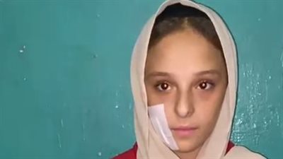 25 غرزة وعاهة مستديمة.. فتاة المرج ضحية الاعتداء على يد صبي: ضربني عشان قولتله ميعاكسنيش | بث مباشر