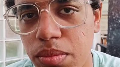 سائق سيارة يدهس طالبًا ويُصيب 5 آخرين بالدقي.. وأحد المصابين: خبطنا وإحنا ماشيين جنب الرصيف | بث مباشر