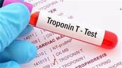 دراسة: المستويات العالية من بروتين معين ترتبط بزيادة مخاطر الوفاة 