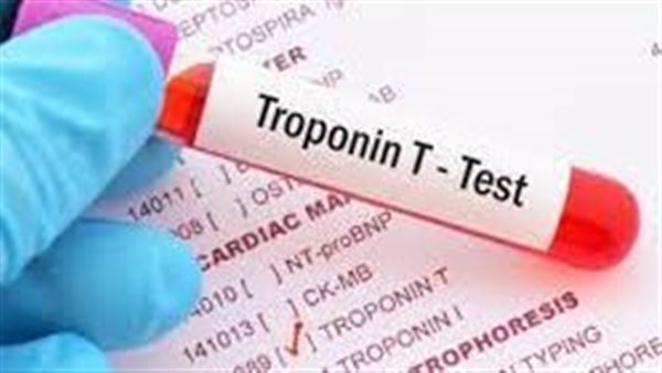 بروتين تروبونين