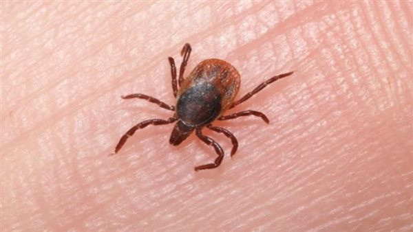 أعراض الإصابة بحمى