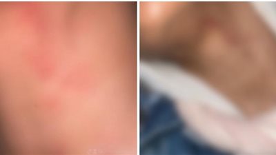 طمعًا في الورث.. فتاة تستغيث من اعتداء شقيقها عليها: بيهددني بالقتل وعذب أختي الصغيرة