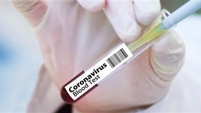 مصدر بـ”الصحة”: تحديث بروتوكول علاج مصابي كورونا وحذف هيدروكسي كلوركين تنفيذًا لتعليمات الصحة العالمية