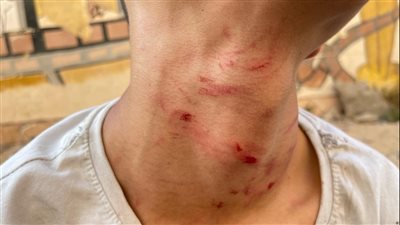 طالب يحرر محضرا ضد مدرس بسنتر للدروس الخصوصية للتعدي عليه بالضرب بكفر الشيخ 