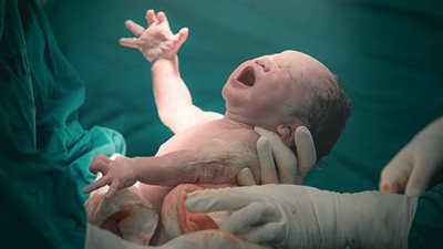 دراسة: الولادة المبكرة أكثر أمانا لصحة الأجنة كبيرة الحجم 