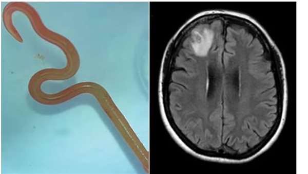 الأشعة المقطعية 