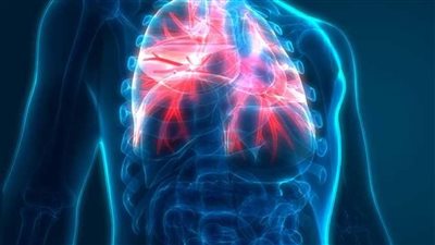 تعرف على مرض الفيالقة والفئات الأكثر عرضة للإصابة  