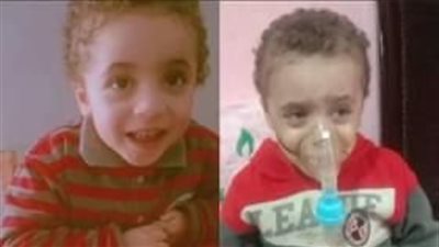 حالته مش مستقرة.. منوفي يستغيث لعلاج ابنه المصاب بضمور عضلات دوشين: علاجه هيكلف 3 ملايين جنيه بالسنة