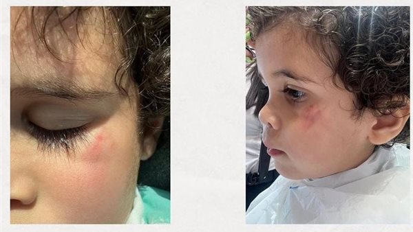 الاعتداء على الطفل