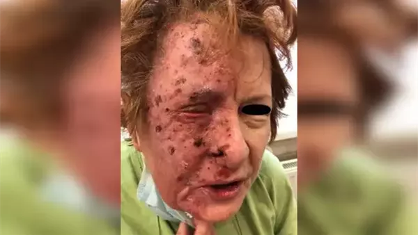 إصابة نادرة لسيدة