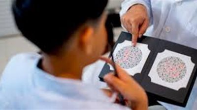 صعوبة التمييز وضعف الرؤية أبرز أعراضه.. ما هو عمى الألوان؟