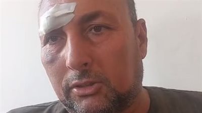 مصرع وإصابة 9 أشخاص استنشقوا مادة سامة بالغربية.. وأحد المصابين: أخواتي الاتنين ماتوا | بث مباشر