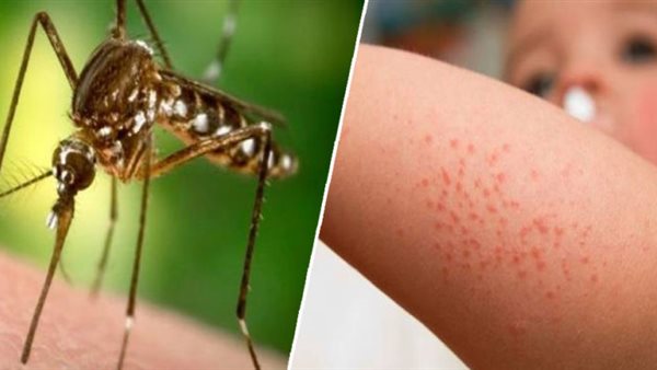 حمى غرب النيل 