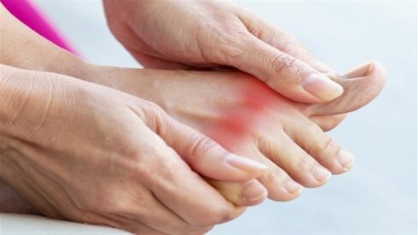 النقرس ـ أرشيفية