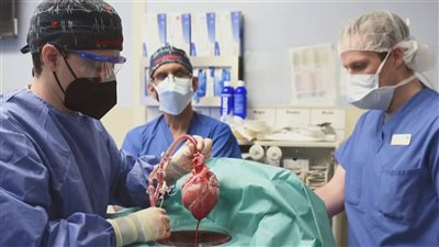 للمرة الثانية.. نجاح عملية زراعة قلب خنزير معدل وراثيا في جسم إنسان
