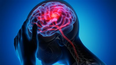 للشباب..5 علامات تحذيرية للإصابة بورم المخ