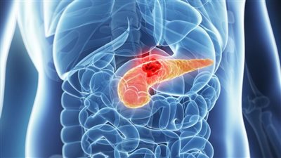 أبرزها عسر الهضم.. دراسة تكشف أعراض الإصابة بـ سرطان المعدة