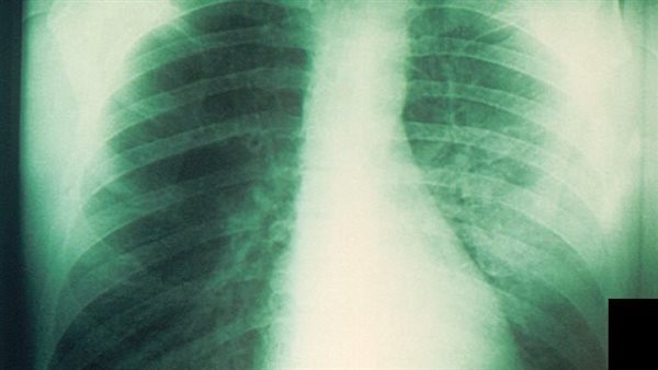 صورة تعبيرية 