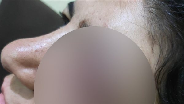 ممرضة السلام ضحية