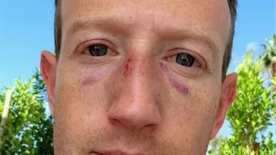  كدمات وإصابات في وجهه.. مارك زوكربيرج يصدم متابعيه على انستجرام