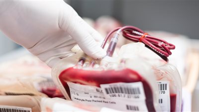 خبراء يحذرون من التبرع بالدم: يسبب الأنيميا  