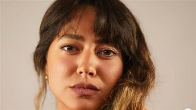 بعد انتقادات إزالتها الحسنة من وجهها.. هند عبد الحليم ترد: استمروا خليكم أشرار أكتر