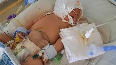 سيدة تضع مولودها على طريق القاهرة الفيوم.. والإسعاف ينقذ حياتها