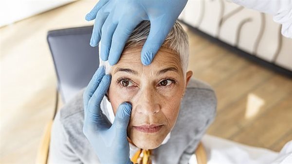 متلازمة الثلج البصري