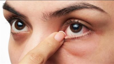 هل يمكن للعين الكشف عن سرطان المعدة؟