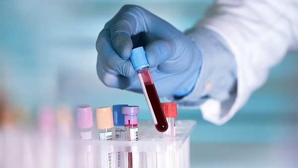 اختبارات الدم