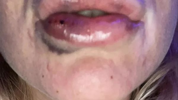 نتائج تجربة ناتالي