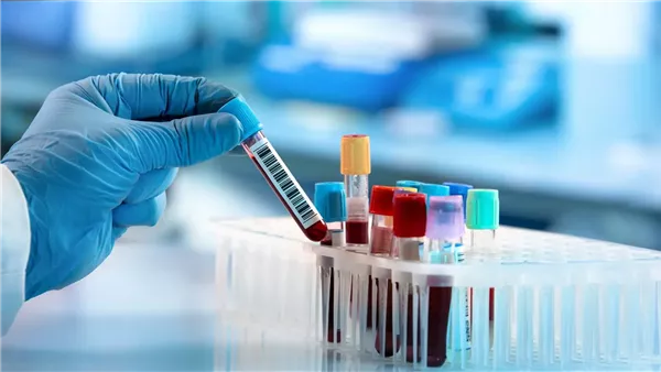 اختبارات الدم