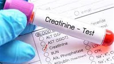 أبرزها الفواكه.. كيف يمكن تعزيز نسبة الكرياتينين في الجسم؟