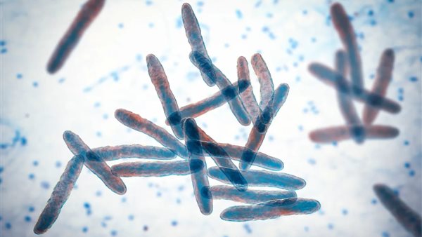 قرحة بورولي