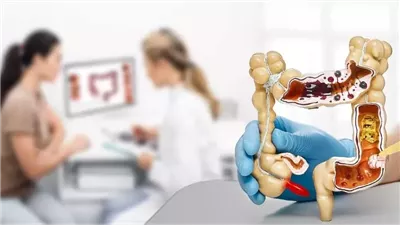 علاج القولون العصبي بدون الحاجة إلى أدوية.. في 10 دقائق فقط