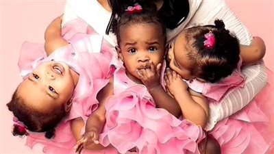 ظاهرة طبية نادرة.. سيدة تحمل في توأم أثناء حملها الأول