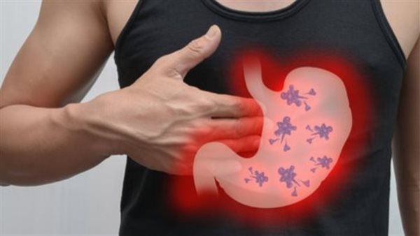 علاج جرثومة المعدة