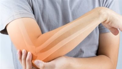 أبرزها ألم المفاصل.. تعرف على مضاعفات مرض هشاشة العظام 