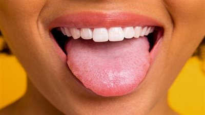  دراسة: لون اللسان يشير لخطر الإصابة بحالة مرضية خطيرة