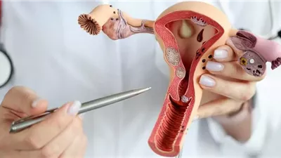 هل يمكن الحمل للمرأة المصابة بتكيس المبايض؟.. طبيب يوضح