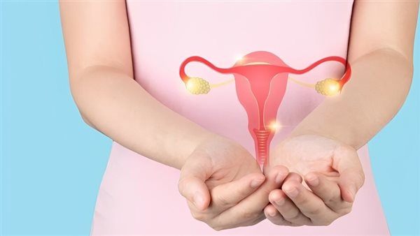 متلازمة تكيس المبايض