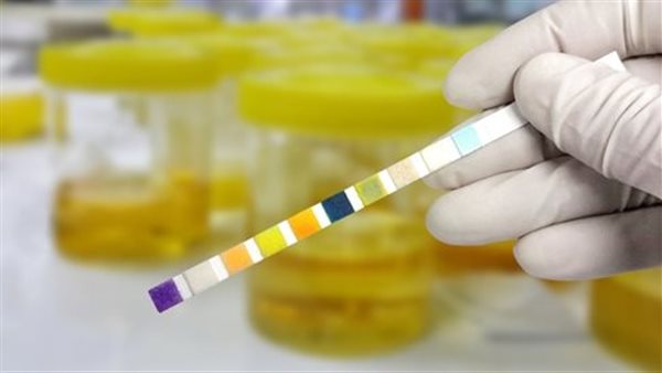 علاج التهاب البول