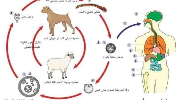 خطورة مرض الأكياس