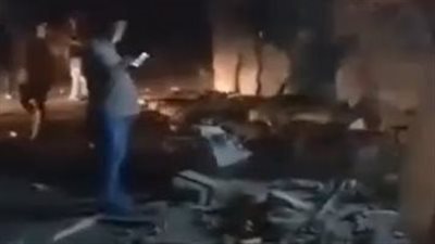 كدمات وجراحة تجميلية بالكف.. تفاصيل الحالة الصحية لمصابي حادث طابا | بث مباشر