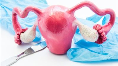 تساقط الشعر والتوتر الزائد.. أبرز علامات تعب الغدة الكظرية لأصحاب متلازمة تكيس المبايض