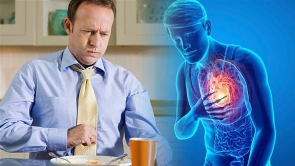 علاج حرقان المعدة