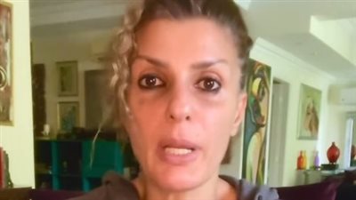 فيدرا تطالب متابعيها بالاستمرار في دعم أهالي غزة: أطفال وأجنة بتموت في بطون أمهاتهم